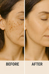 {{product_title}} – Natural {{product_type}} for Healthy {{target_area}} | Bee Nature's Essence