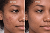 {{product_title}} – Natural {{product_type}} for Healthy {{target_area}} | Bee Nature's Essence