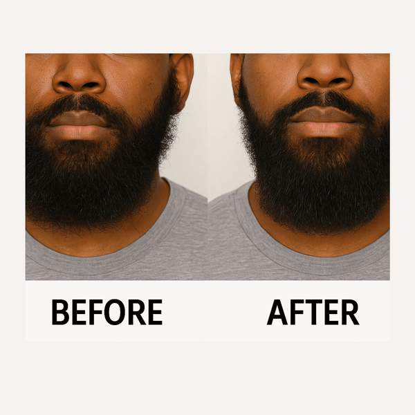 {{product_title}} – Natural {{product_type}} for Healthy {{target_area}} | Bee Nature's Essence