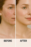 {{product_title}} – Natural {{product_type}} for Healthy {{target_area}} | Bee Nature's Essence