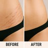 {{product_title}} – Natural {{product_type}} for Healthy {{target_area}} | Bee Nature's Essence