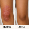 {{product_title}} – Natural {{product_type}} for Healthy {{target_area}} | Bee Nature's Essence