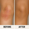{{product_title}} – Natural {{product_type}} for Healthy {{target_area}} | Bee Nature's Essence