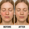 {{product_title}} – Natural {{product_type}} for Healthy {{target_area}} | Bee Nature's Essence